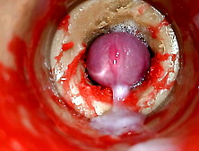 Web camera 4k in Snatch,  Cervix SELF PERSPECTIVE,  "Cream-pie",  "Fucking breed me" ASMR SEX