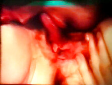 Oral Connection - Mary Millington Hardcore Seventies Short John Lindsay