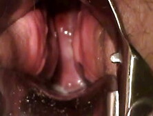 Bbw Masturbate With Speculum Show Cervix Contracting Orgasm