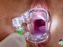 Gynoexclusive - Anita Blanche