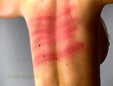 Corporal punishment to back by machine