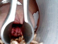 using a speculum to put maggots in my cock