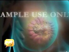 Latinas Having Mammograms