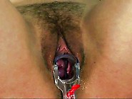 Seduced by dr. lesbian