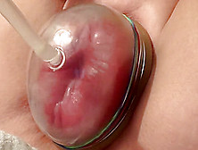 Elle a toujours rêvé d'avoir de grosses lèvres lol