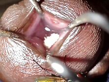 Fly laying eggs in my urethra full ver 2