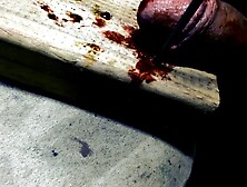 DIY Box Cutter Penectomy