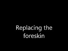 The Natural Foreskin,  Retraction & The Frenulum