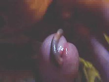 Earthworm in urethra