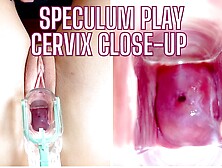 Stella St.  Rose - Speculum Play,  See My Cervix Close Up