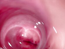Camera deep inside Mia's creamy pussy,  teen Cervix close up
