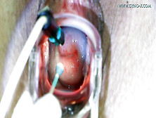 Skinny Harlot Comes To Her Gyno Doctor And Needs To Pass Full Exam