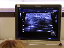 Brunette Girl's Mammogram & Breast Ultrasound