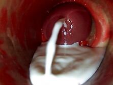 Camera Inside Deep Pussy Captures Huge Ejaculation of Sperm ASMR