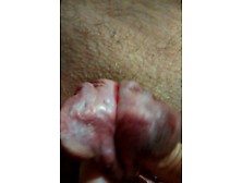 subincision split cock 13