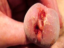 Tiny Cock Bleeding As Maggots Enjoy Their Meal