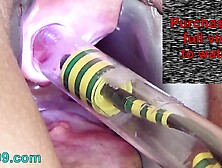 Woman Pee Hole Playing Urethral Insertion With Endoscope Cam