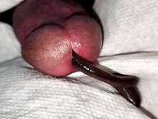 Worm In Urethra