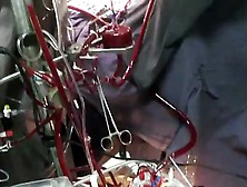 Woman Going To Cardiopulmonary Bypass Cm. Flv