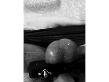 A cannula through both balls