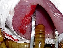 Mealworm feast inside my peehole