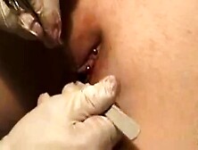 Female circumcision - MODCON