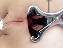 Look Inside My Asshole (Anal Speculum)