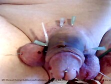 20250924 taking Johns needles out