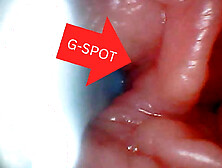 First time: An endoscope reveals the G-spot up close - without mountingl
