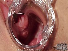 Nasty Day W23Yo Santana Gyno Speculum Gape Anal Beads Hitachi Inside Cunt Walls Convulse Cums