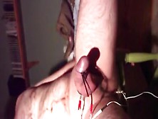 Estim With A Anal Probe