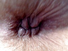Extreme Closeup Anus Hairy Blue Fingernails